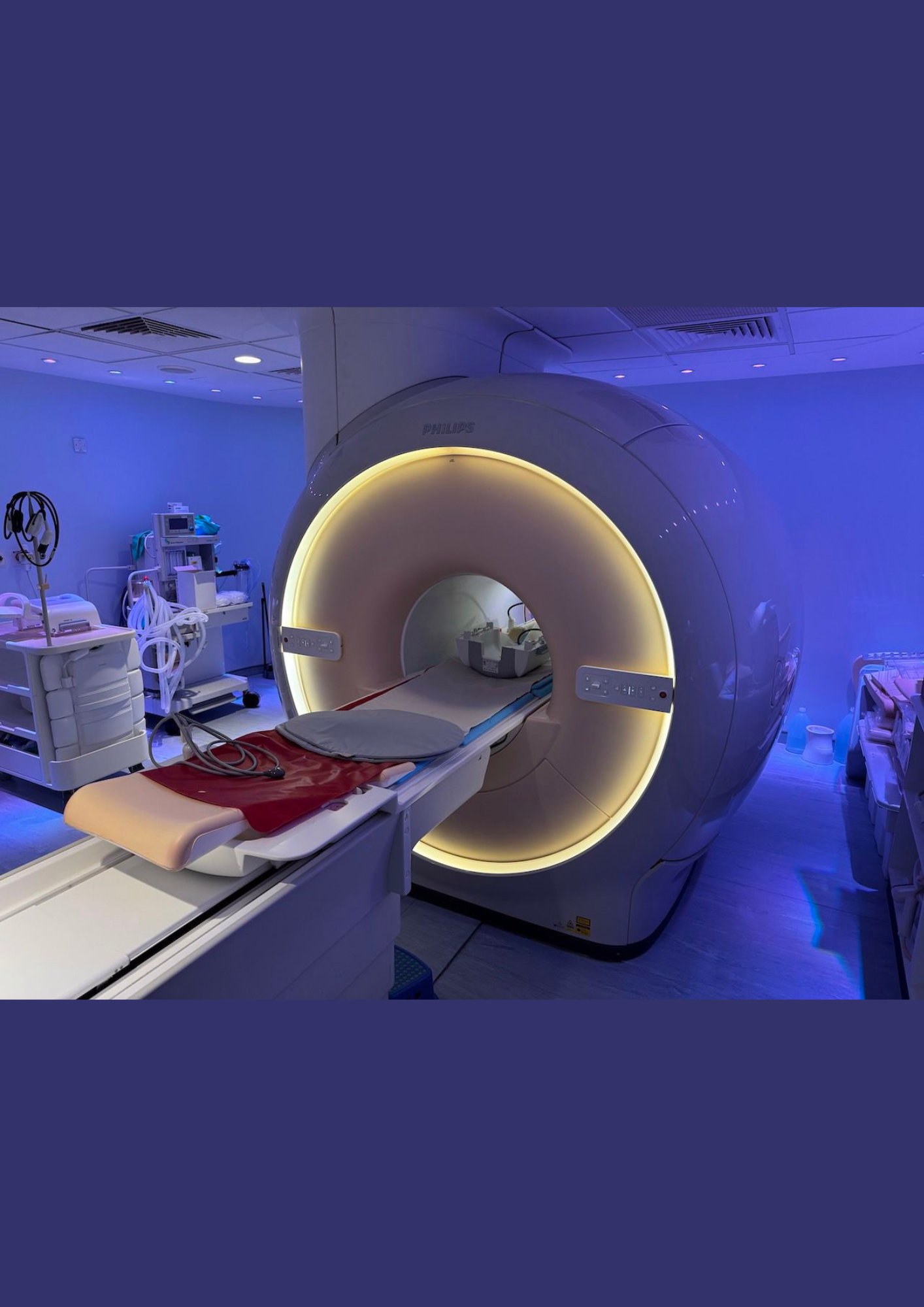 MRI Philips Ingenia 1.5T - obrazek 2